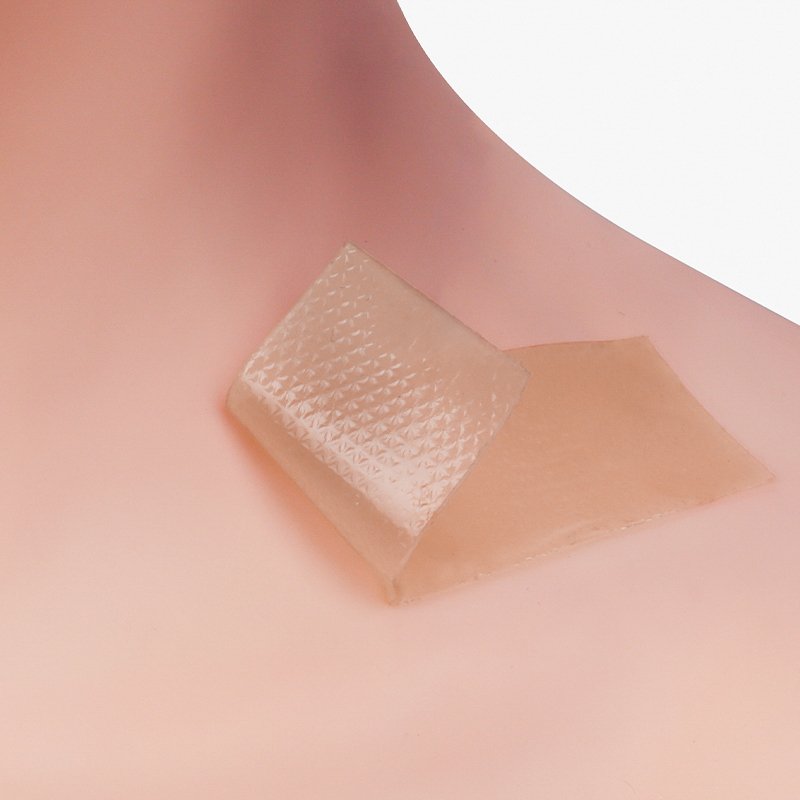 Alexer Silicone Scar Strip — Self Adhesive Silicone Gel